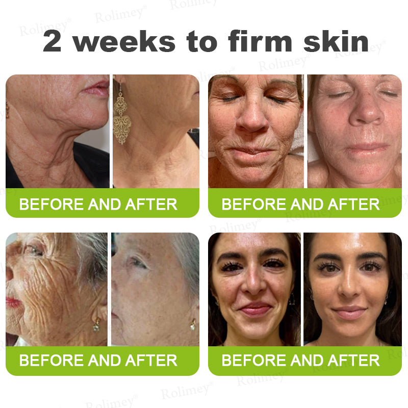 👨‍⚕️Made and shipped from Australia💫 A Retinol Shot Wrinkle-Lift Tightening cream - Last Day Promotion 70% OFF