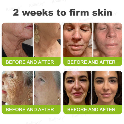 👨‍⚕️Made and shipped from Australia💫 A Retinol Shot Wrinkle-Lift Tightening cream - Last Day Promotion 70% OFF