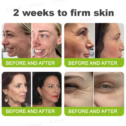 👨‍⚕️Made and shipped from Australia💫 A Retinol Shot Wrinkle-Lift Tightening cream - Last Day Promotion 70% OFF