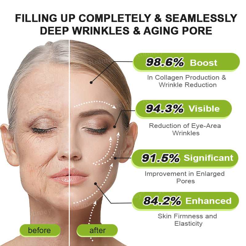 👨‍⚕️Made and shipped from Australia💫 A Retinol Shot Wrinkle-Lift Tightening cream - Last Day Promotion 70% OFF