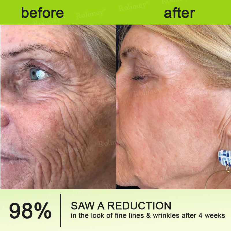 👨‍⚕️Made and shipped from Australia💫 A Retinol Shot Wrinkle-Lift Tightening cream - Last Day Promotion 70% OFF