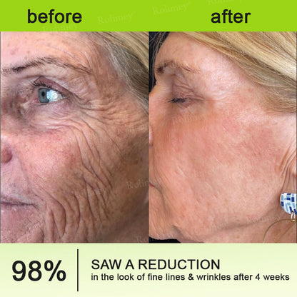 👨‍⚕️Made and shipped from Australia💫 A Retinol Shot Wrinkle-Lift Tightening cream - Last Day Promotion 70% OFF