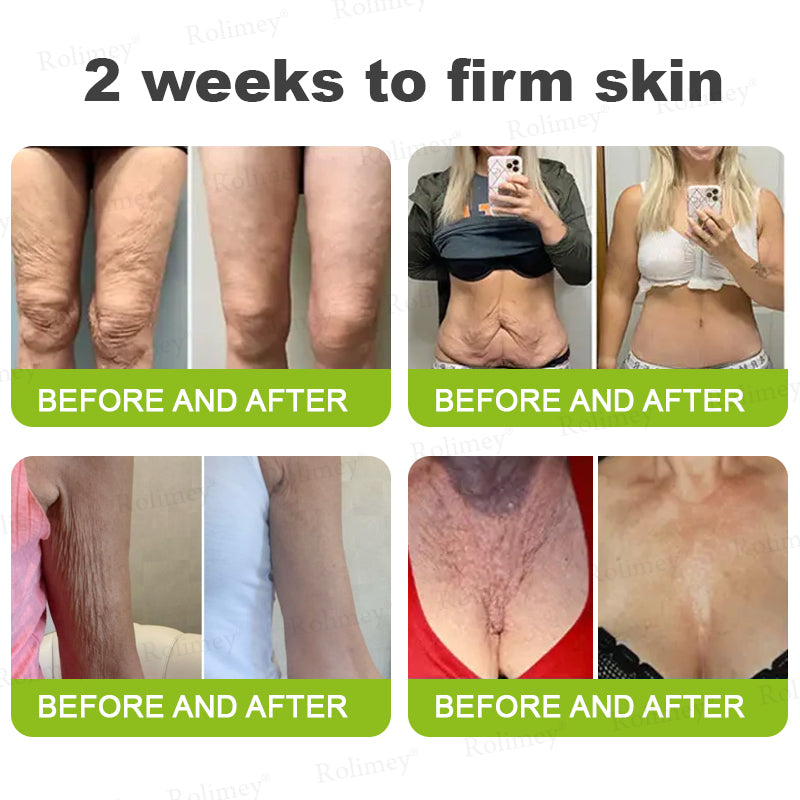 👨‍⚕️Made and shipped from Australia💫 A Retinol Shot Wrinkle-Lift Tightening cream - Last Day Promotion 70% OFF