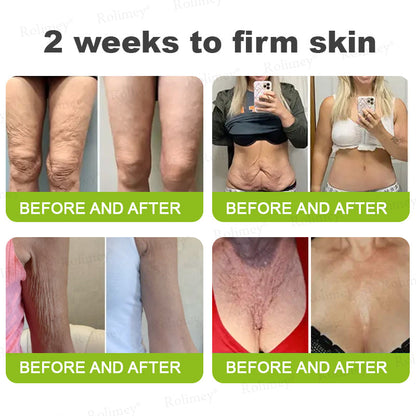 👨‍⚕️Made and shipped from Australia💫 A Retinol Shot Wrinkle-Lift Tightening cream - Last Day Promotion 70% OFF