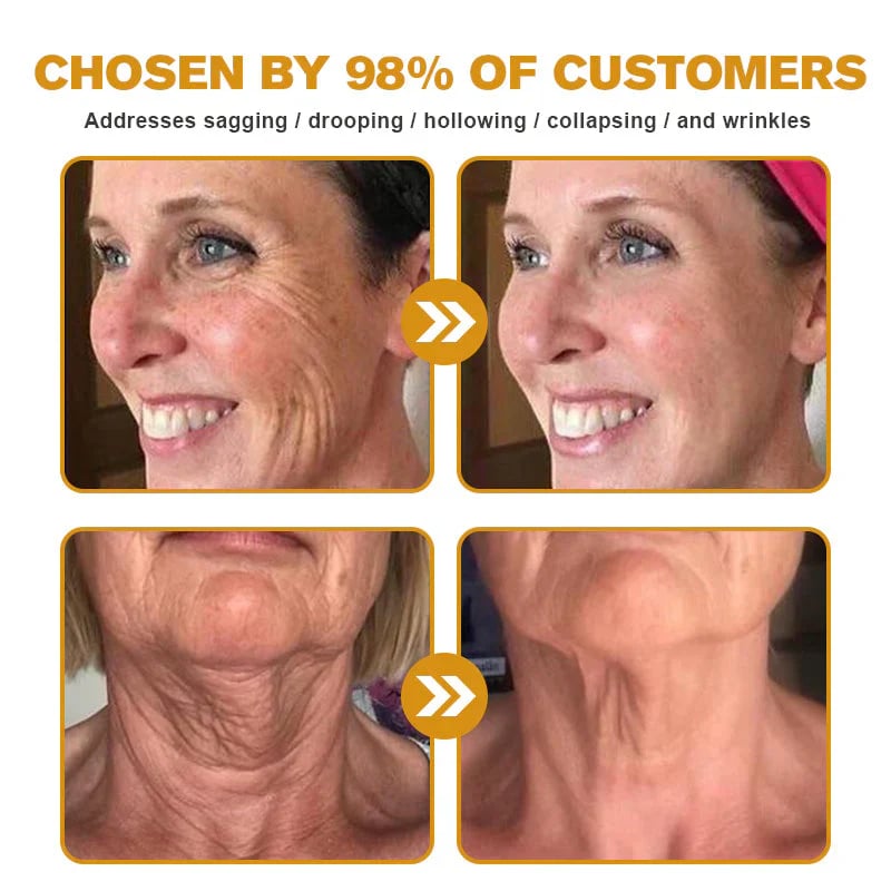 🔥 Limited-Time Special🔥Bee Venom Wrinkle Removal Cream