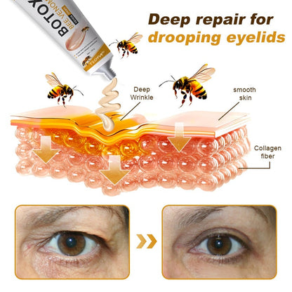 🔥 Limited-Time Special🔥Bee Venom Wrinkle Removal Cream